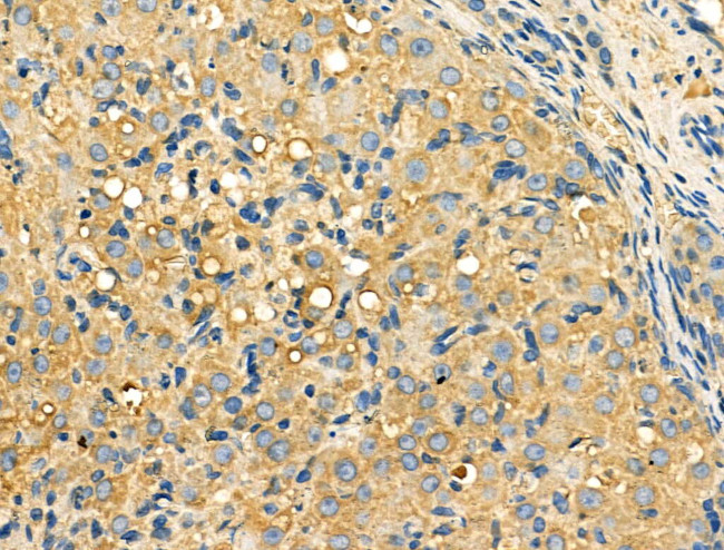 Galectin 9 Antibody in Immunohistochemistry (Paraffin) (IHC (P))