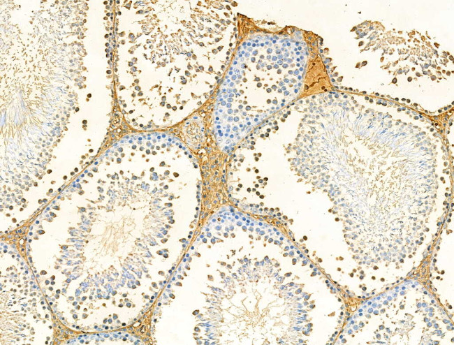 Galectin 9 Antibody in Immunohistochemistry (Paraffin) (IHC (P))