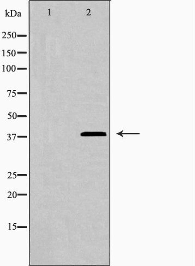 Galectin 9 Antibody in Western Blot (WB)