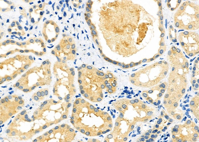 GALNS Antibody in Immunohistochemistry (Paraffin) (IHC (P))