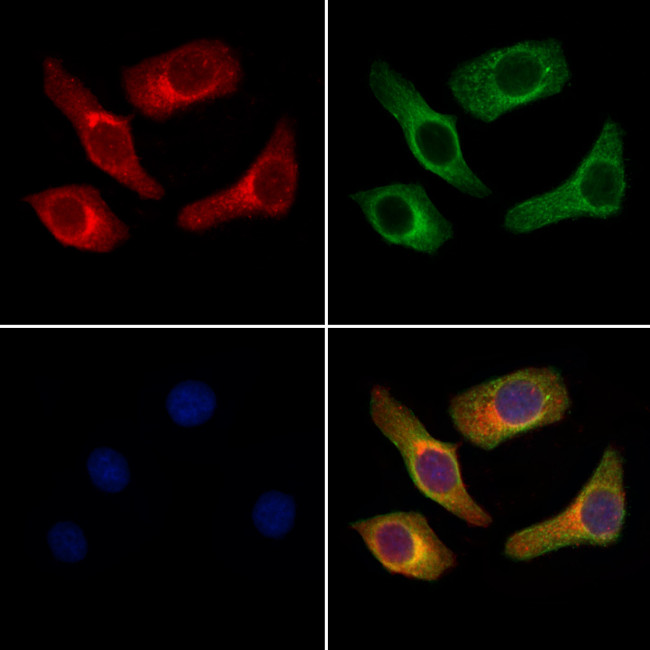 Bombesin Antibody in Immunocytochemistry (ICC/IF)