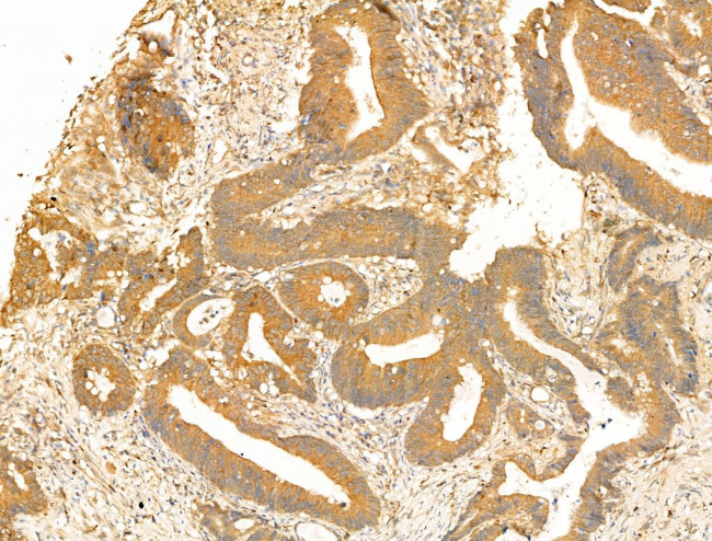 GCHFR Antibody in Immunohistochemistry (Paraffin) (IHC (P))