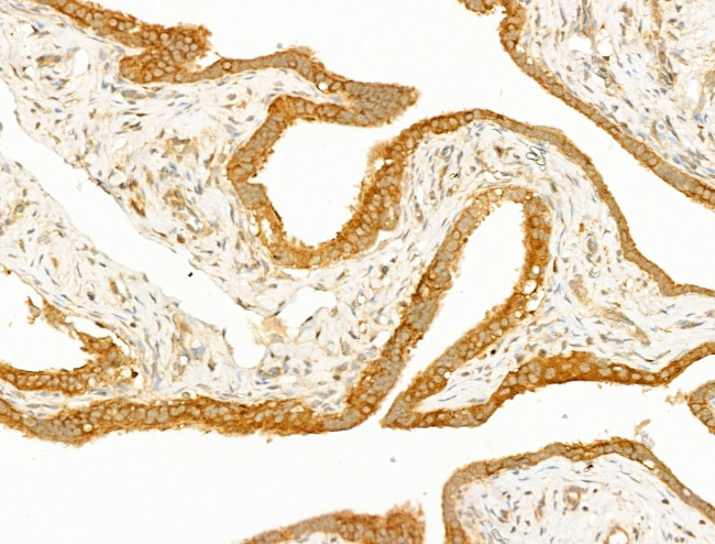 GCHFR Antibody in Immunohistochemistry (Paraffin) (IHC (P))