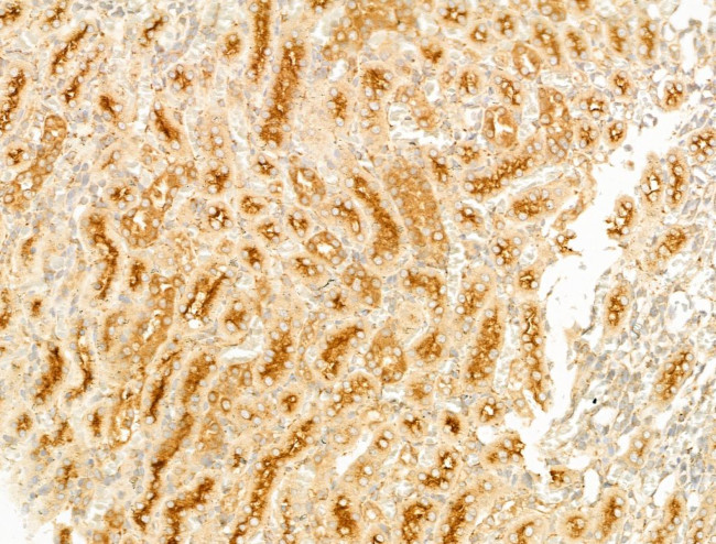 GCHFR Antibody in Immunohistochemistry (Paraffin) (IHC (P))