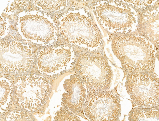 GCHFR Antibody in Immunohistochemistry (Paraffin) (IHC (P))