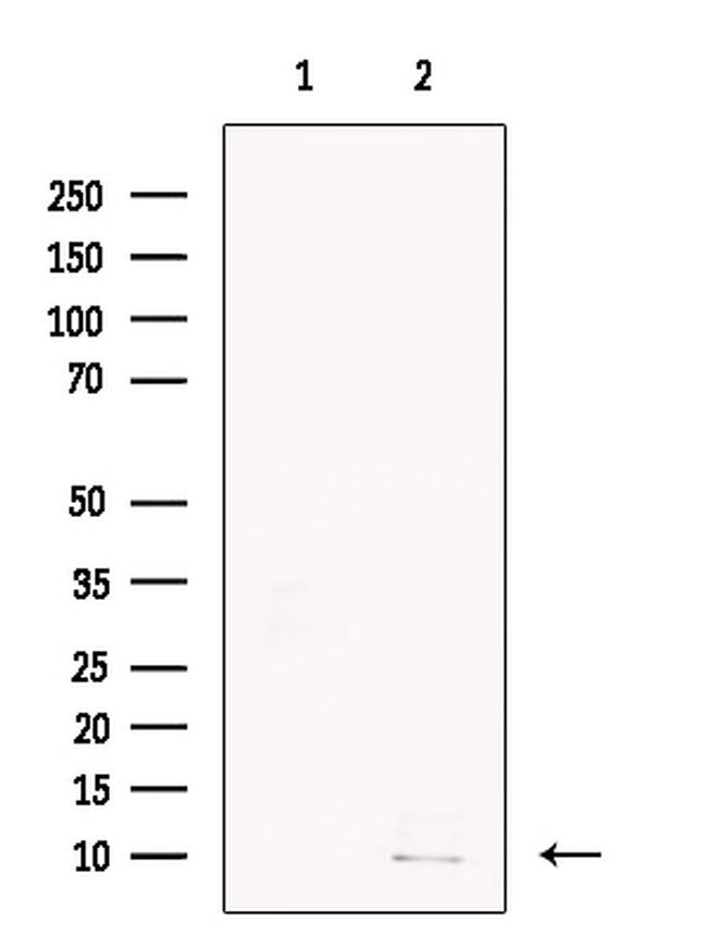 GCHFR Antibody in Western Blot (WB)