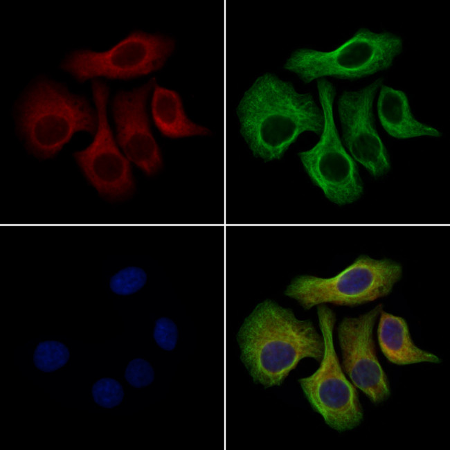 CXCL6 Antibody in Immunocytochemistry (ICC/IF)