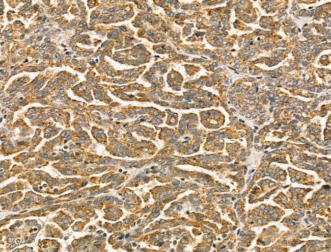 MSTN Antibody in Immunohistochemistry (Paraffin) (IHC (P))