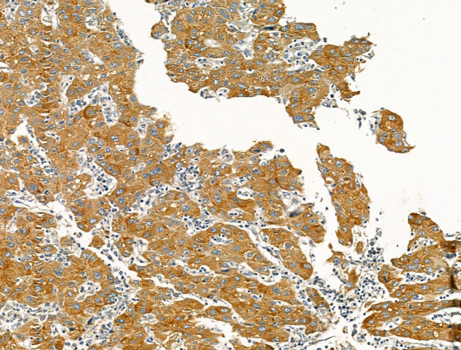 MSTN Antibody in Immunohistochemistry (Paraffin) (IHC (P))