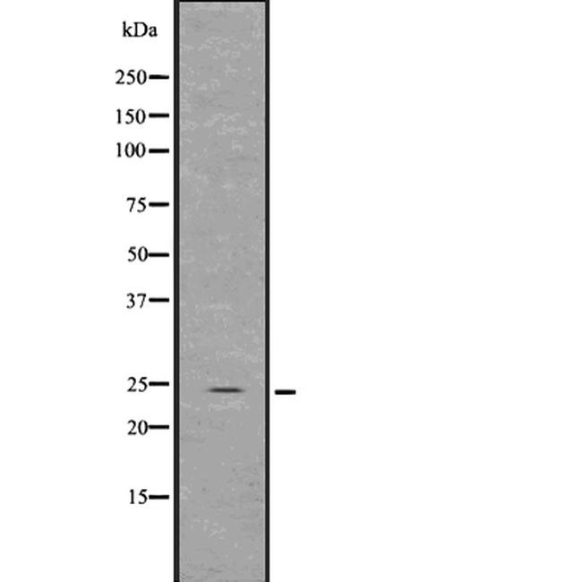 GDNF Antibody in Western Blot (WB)