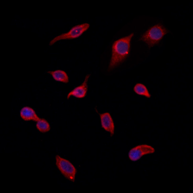 Gelsolin Antibody in Immunocytochemistry (ICC/IF)