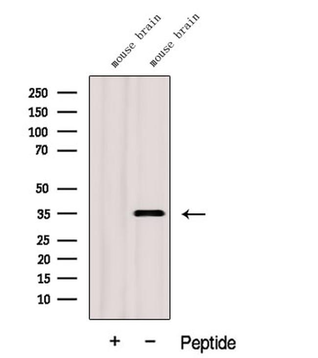 GGPS1 Antibody in Western Blot (WB)