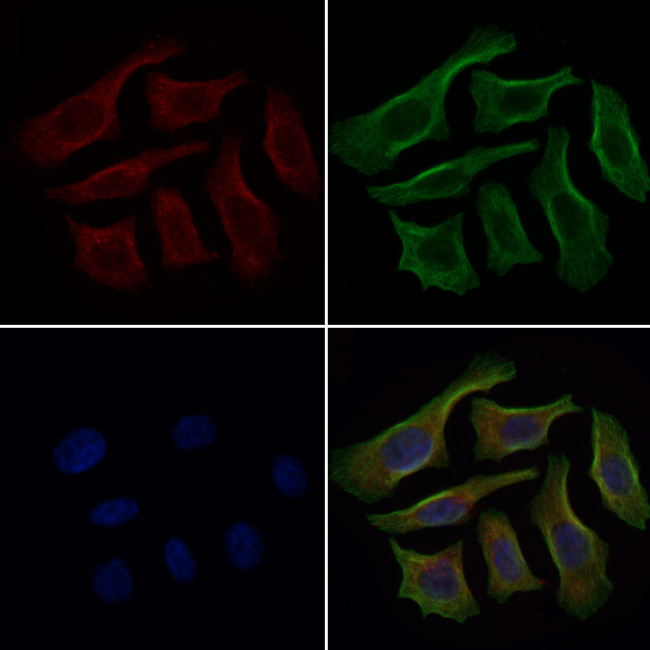 CRG-L2 Antibody in Immunocytochemistry (ICC/IF)