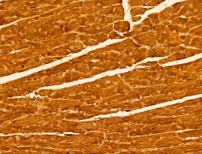 C17orf25 Antibody in Immunohistochemistry (Paraffin) (IHC (P))