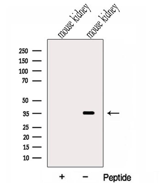 C17orf25 Antibody in Western Blot (WB)