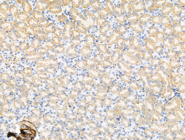 GLRA2 Antibody in Immunohistochemistry (Paraffin) (IHC (P))