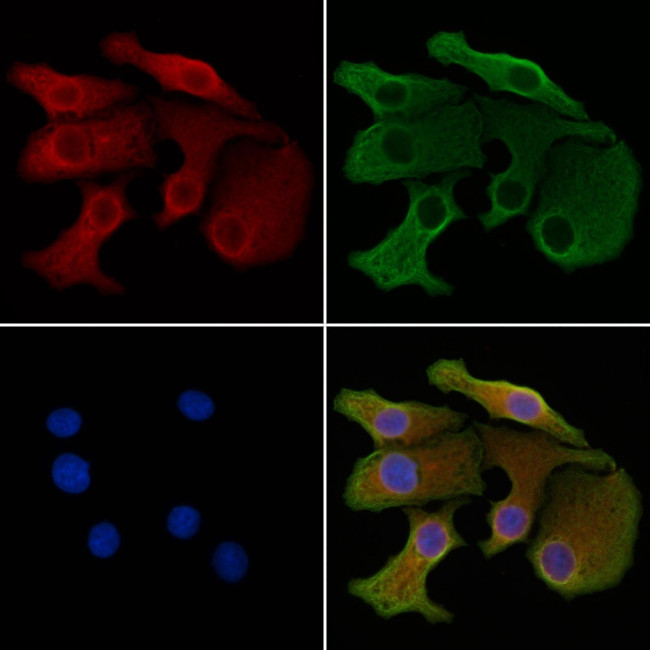 GLS2 Antibody in Immunocytochemistry (ICC/IF)