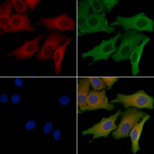 GLS2 Antibody in Immunocytochemistry (ICC/IF)