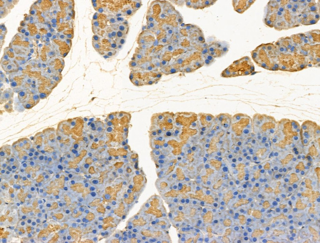 GLS2 Antibody in Immunohistochemistry (Paraffin) (IHC (P))