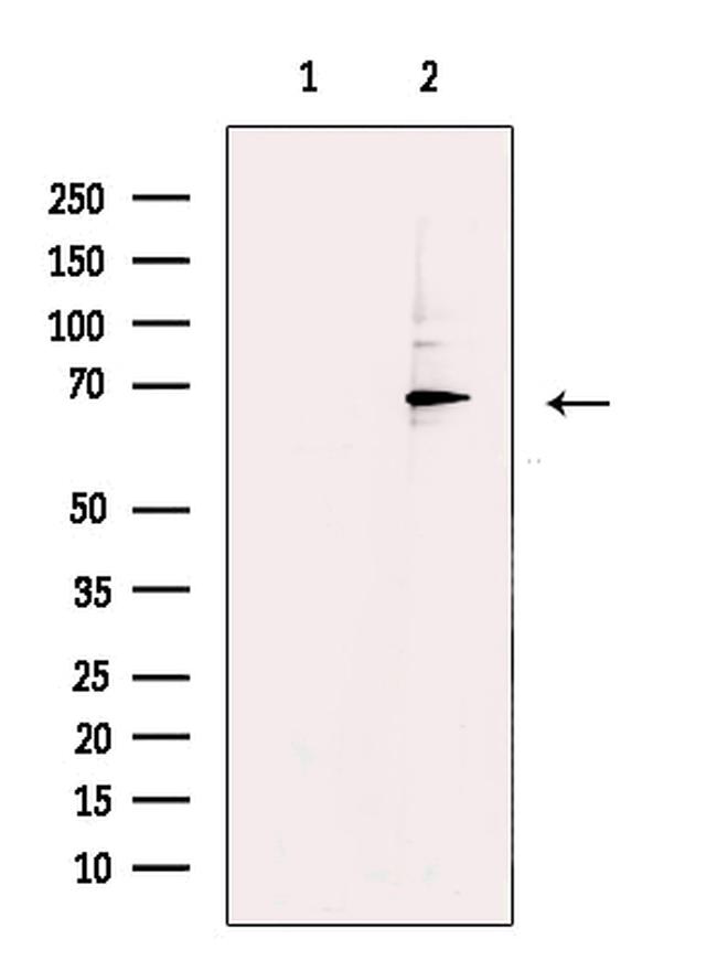 GLS2 Antibody in Western Blot (WB)