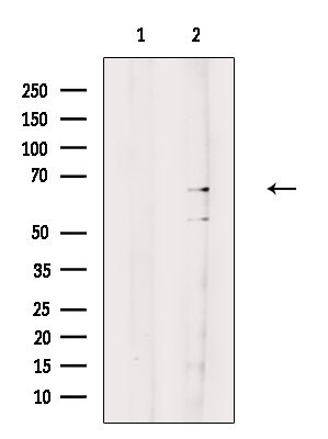 GLS2 Antibody in Western Blot (WB)