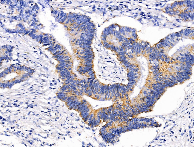 GLUT5 Antibody in Immunohistochemistry (Paraffin) (IHC (P))