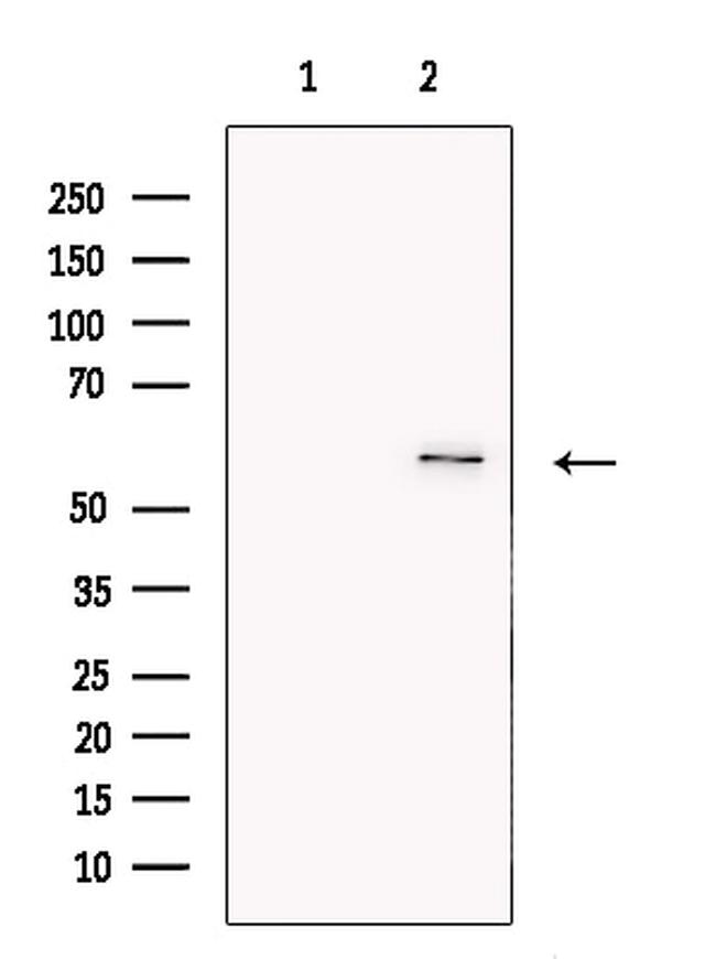 GLUT5 Antibody in Western Blot (WB)