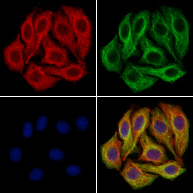 Glutaminase Antibody in Immunocytochemistry (ICC/IF)