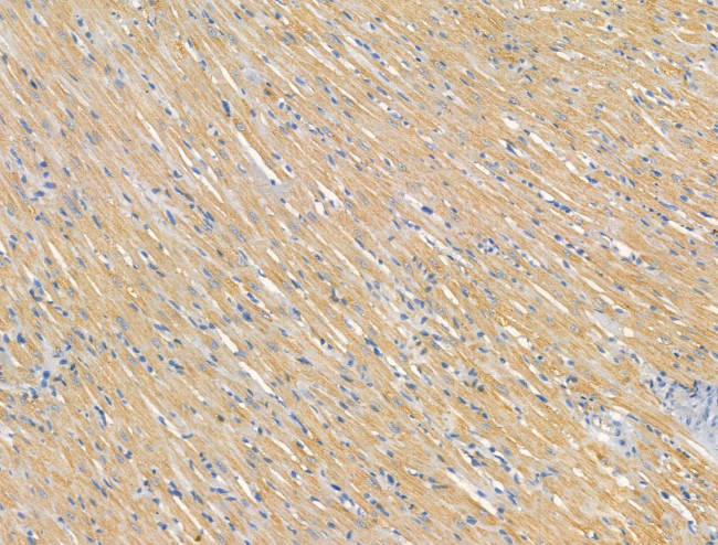 Glutaminase Antibody in Immunohistochemistry (Paraffin) (IHC (P))