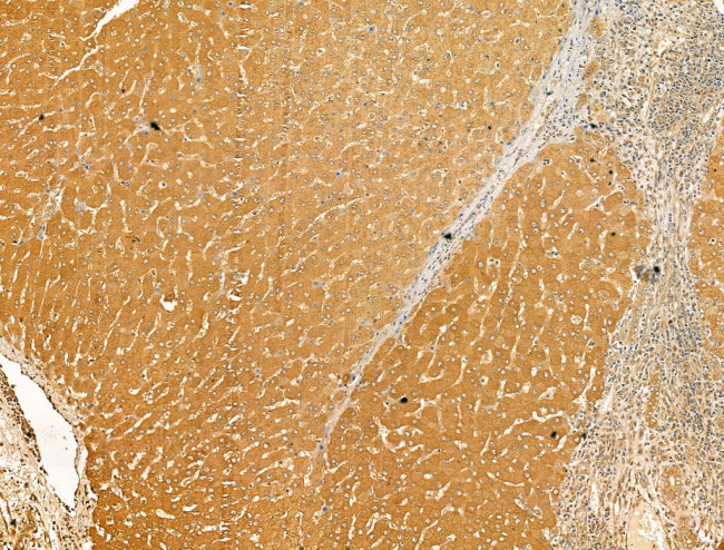 Glutaminase Antibody in Immunohistochemistry (Paraffin) (IHC (P))