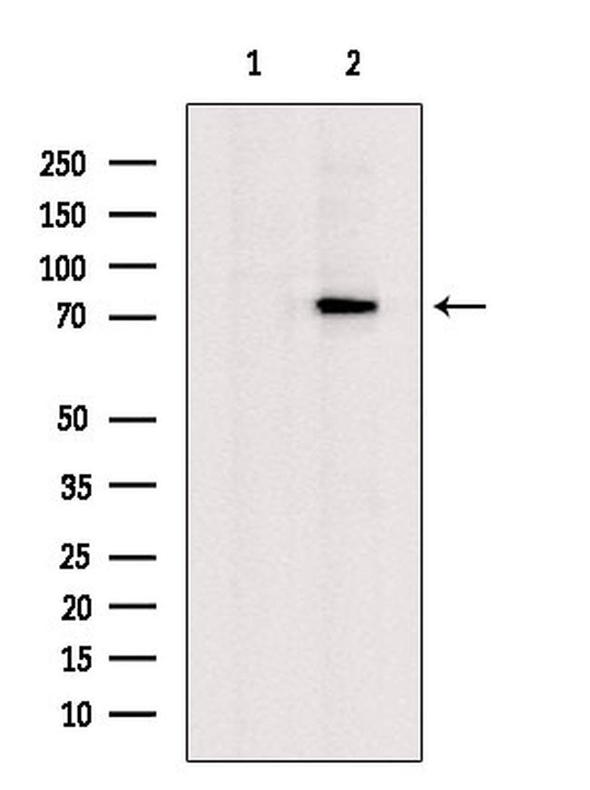 Glutaminase Antibody in Western Blot (WB)