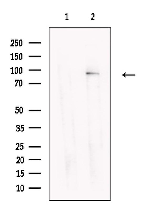 GYS2 Antibody in Western Blot (WB)