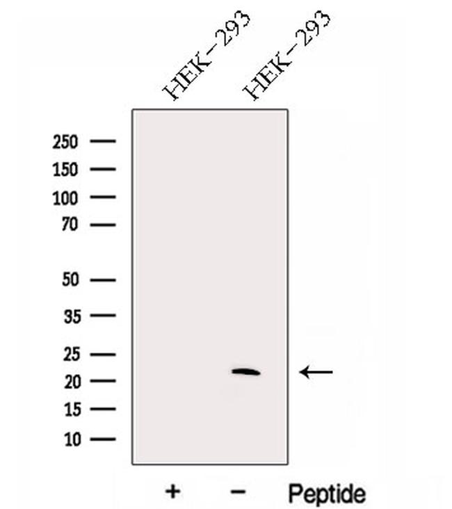 GM2A Antibody in Western Blot (WB)