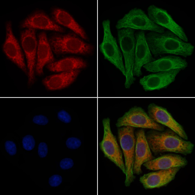 GNAS Antibody in Immunocytochemistry (ICC/IF)