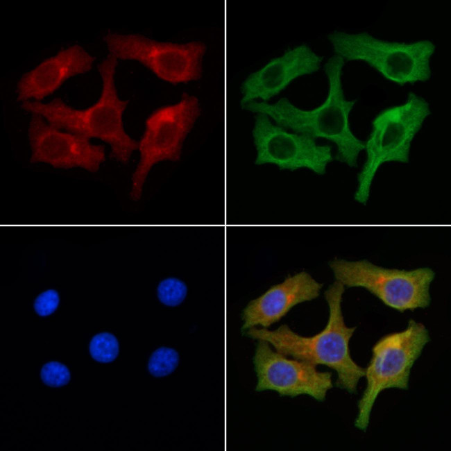 ZDHC3 Antibody in Immunocytochemistry (ICC/IF)