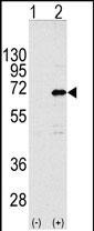 CNOT4 Antibody in Western Blot (WB)