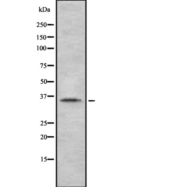 A33 Antibody in Western Blot (WB)