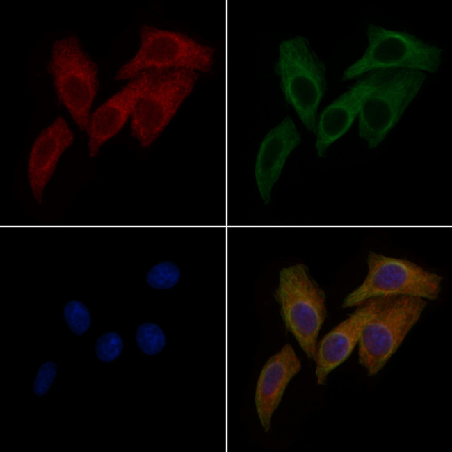 TEM5 Antibody in Immunocytochemistry (ICC/IF)