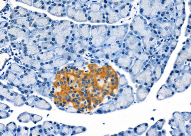 TEM5 Antibody in Immunohistochemistry (Paraffin) (IHC (P))