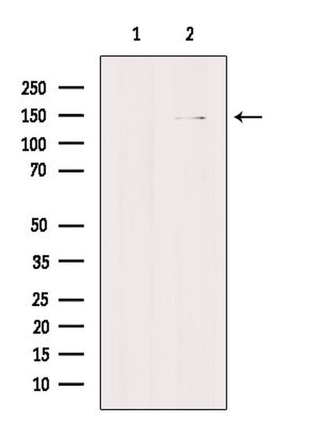 TEM5 Antibody in Western Blot (WB)