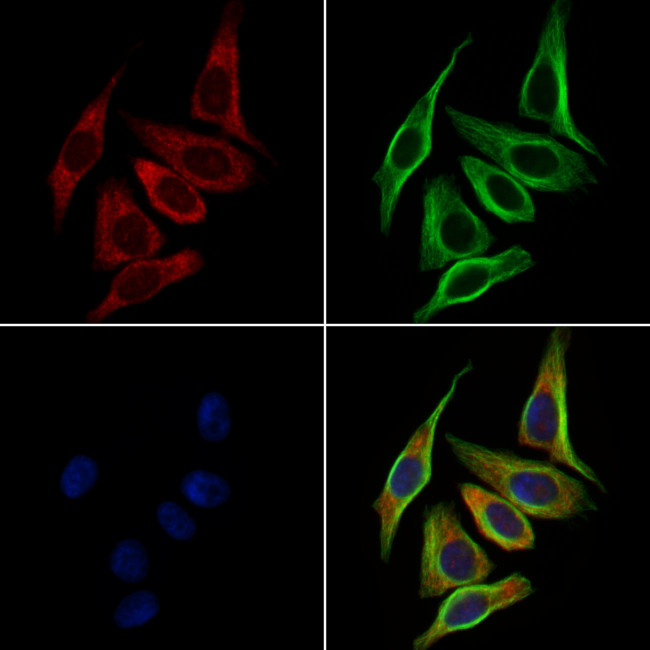 GPR182 Antibody in Immunocytochemistry (ICC/IF)