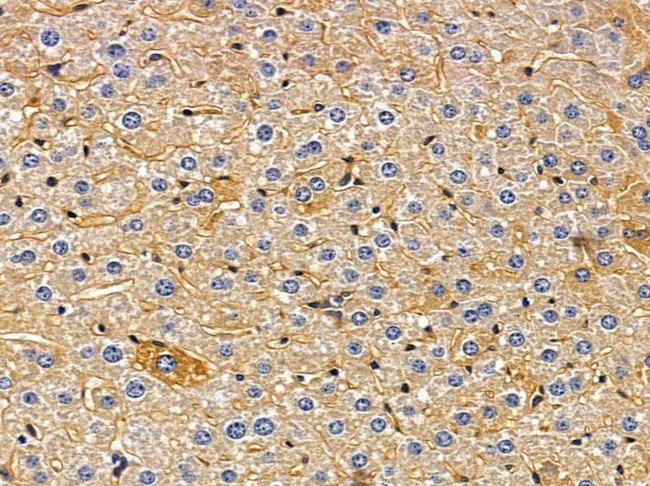 GPR182 Antibody in Immunohistochemistry (Paraffin) (IHC (P))