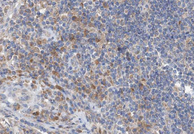 GZMB/GZMH Antibody in Immunohistochemistry (Paraffin) (IHC (P))