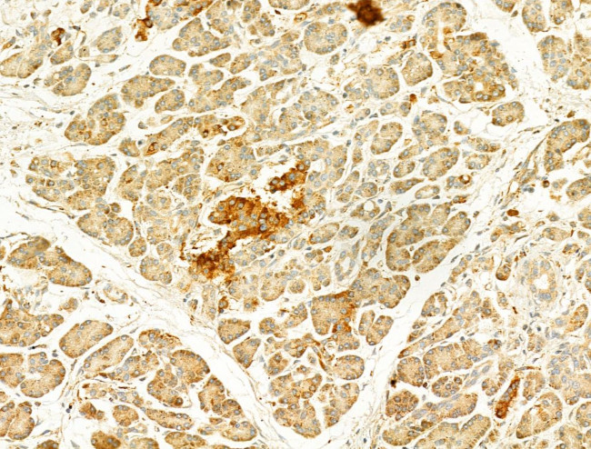 GZMB/GZMH Antibody in Immunohistochemistry (Paraffin) (IHC (P))