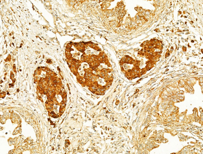 GZMB/GZMH Antibody in Immunohistochemistry (Paraffin) (IHC (P))