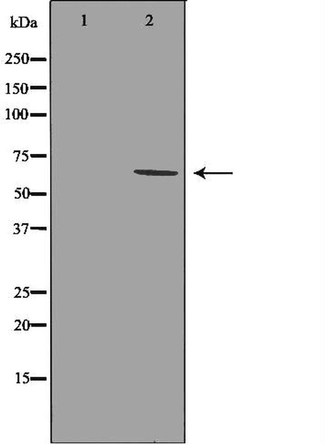 GRK1 Antibody in Western Blot (WB)