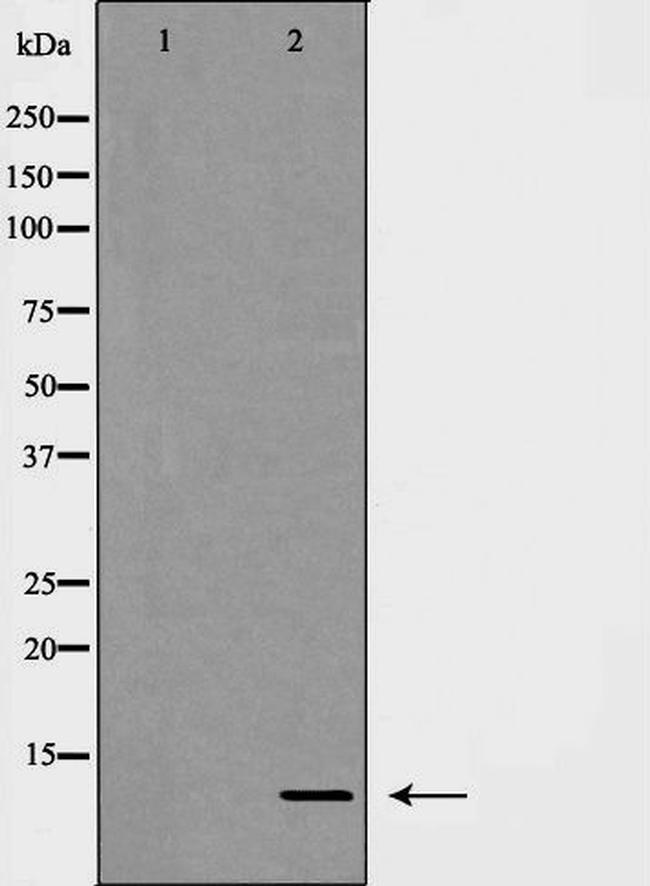 CXCL1 Antibody in Western Blot (WB)