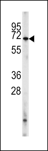 PDE8A Antibody in Western Blot (WB)