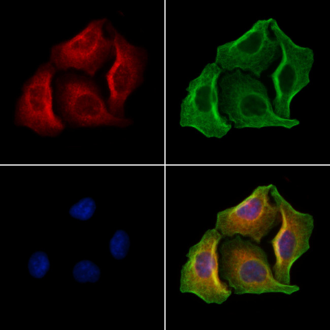 GSDMD Antibody in Immunocytochemistry (ICC/IF)