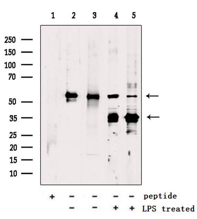 GSDMD Antibody in Western Blot (WB)